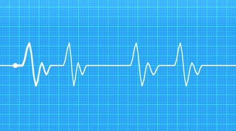 Realistic indicators of human heartbeat Stock Footage 67406733
