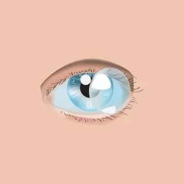 Realistic style vector illustration with eye and contact lens Stock Illustration