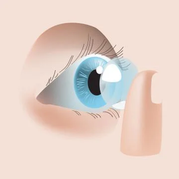Realistic style vector illustration with eye and contact lens Stock Illustration
