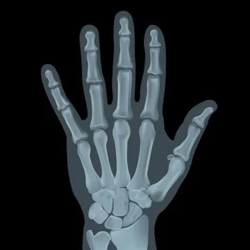 Realistic x-ray shots.Image uses a grid gradient. Stock Illustration