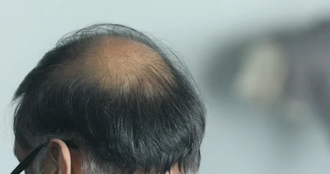 Rear view of a Bald Head Man Stock Footage 260448934