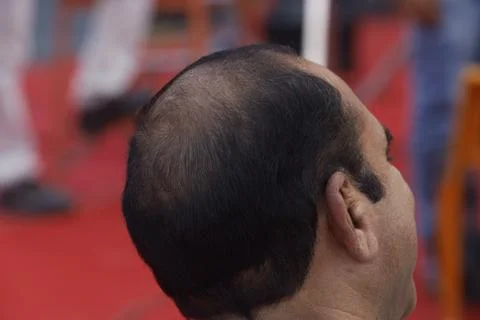 Rear view of Bald head man Stock Photos