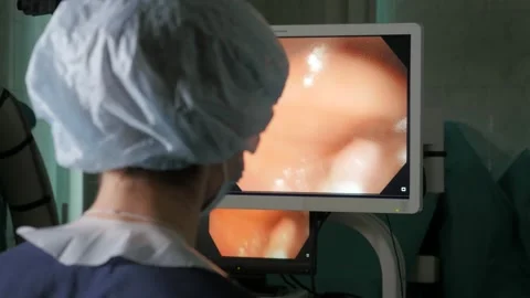 Rear view of endoscopist surgeon doing endoscopic polypectomy Stock Footage 167108937
