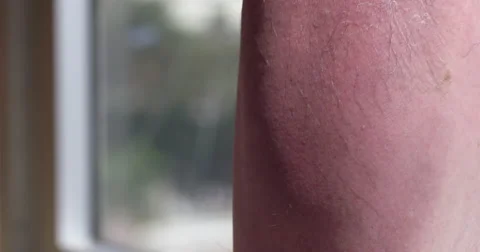 Rear view of hand gently applying lotion to sunburned leg 4K Stock Footage 65059653