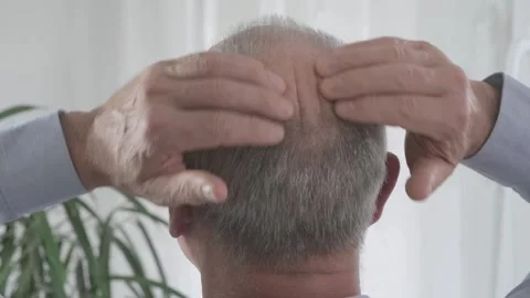 Rear view older man with bald patches on scalp, showing signs alopecia and .. 库存影片 289633580