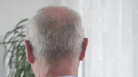 Rear view older man with bald patches on scalp, showing signs alopecia and .. 库存影片 292014167