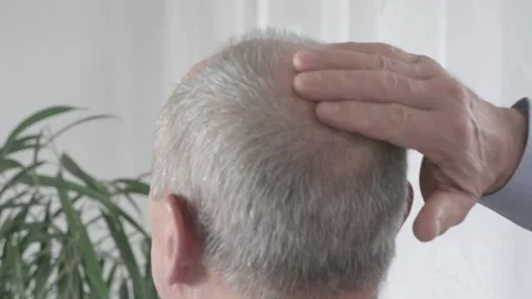 Rear view older man with bald patches on scalp, showing signs alopecia and .. 库存影片 298001933