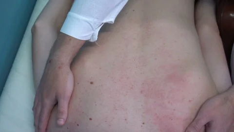 On reception at the masseur. Masseur doing massage to her patient Vídeo Stock 77189595