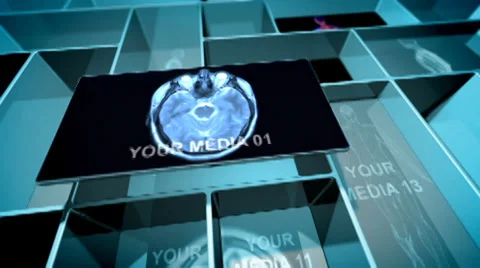 RECESSES (loop) After Effects stock