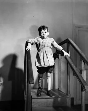 RECORD DATE NOT STATED Child cripped by infantile paralysis. Photographs o... Foto stock