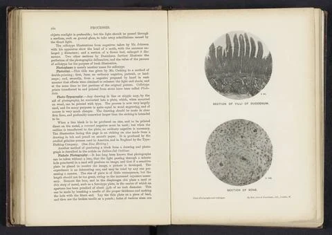 RECORD DATE NOT STATED  Section of villi of duodenum, anonymous, c. 1889 -... Stock Photos