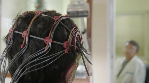 Recording electrical impulses of patient brain, placed electrodes on scalp Stock Footage 75807313