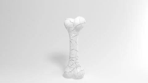 Recovery of the bone isolated on white background, 3d rendering. Stock Footage 149949438
