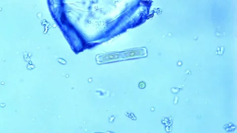 Rectangular Diatom gliding among microplastic contamination Stock Footage 302708972
