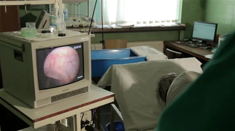 Rectoscopy. Review of colon with camera. Examination. Rectum on monitor screen. Stock Footage 52962939