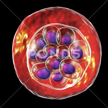 Red blood cells infected with malaria parasite Plasmodium vivax ...