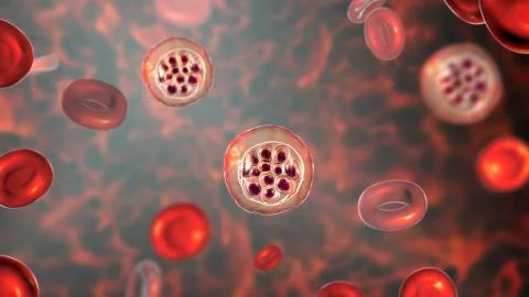 Red blood cells infected with malaria parasite Plasmodium vivax Stock Illustration