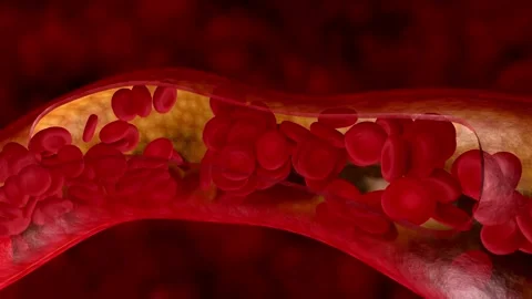 Red blood cells moving through a human artery in 3D animation Stock-Footage 333484356