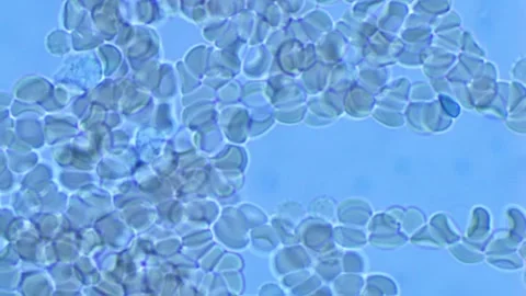 Red Blood cells under microscope-1000 Magnification Stock Footage 302709005