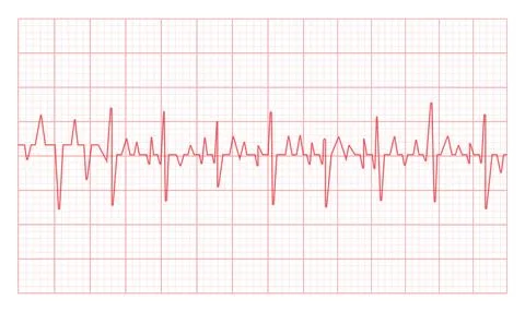 Red ECG Cardiogram Grid Background Stock Illustration