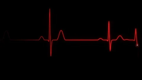 Red ECG line going flat between heartbeats on a black background for medical Vídeo Stock 344666521