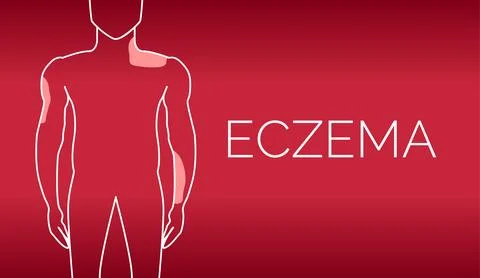 Red Eczema Background Illustration Design Stock Illustration