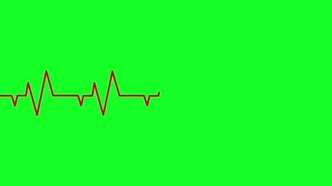 Red electrocardiogram pulse line animation showing healthy heart rhythm on .. Stock Footage 345547866