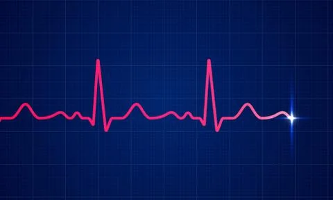 Red heart beat pulse electrocardiogram rhythm on blue cardio chart monitor ba Illustrazione stock