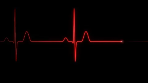 Red heartbeat ECG line with sharp QRS peaks on a black background for medical Vídeo Stock 344666517