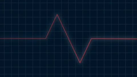 Red heartbeat pulse rhythm on electrocardiogram, type monitor, healthcare con Stock Footage 101063360