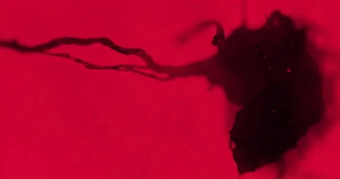 Red horror bacteria and large dark veins under a microscope. Thriller vein Stock Footage 198731534