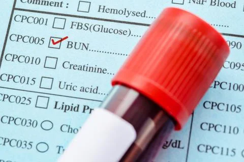 Red mard on Bunl function test. Stock Photos