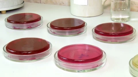 Red microorganisms in a petri dish. Stock Footage 127321579