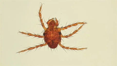 Red mite under the microscope Stock Footage 111023825