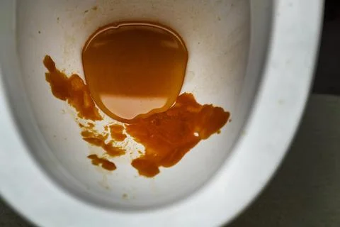 Red-orange paste-like substance in white toilet bowl, unflushed, showing po.. Stock Photos