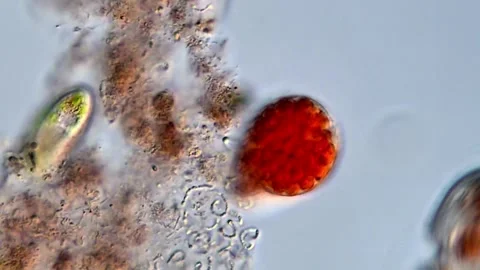 Red protozoa under DIC microscope Video stock 318002066