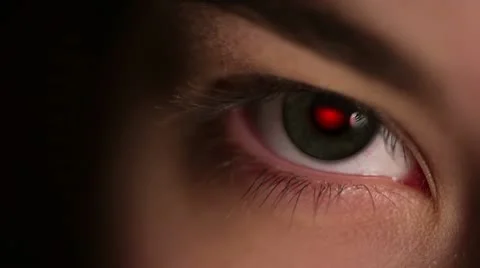 Red Pupil of the Eye Stock Footage 10725030