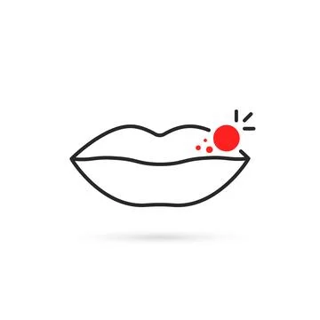 Red rash on black thin line lips Stock Illustration