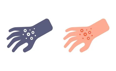 Red rash on hand icon. Stock Illustration