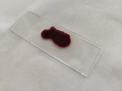 Red sample in a slide to be analysed in a laboratory Stock Photos