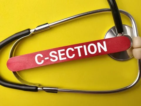A red stick labeled C SECTION rests across a metal stethoscope on a bright .. Stock Photos