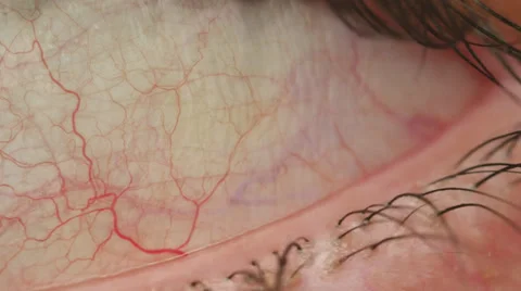 Red Vein Eye Closeup Macro Body Part HD Stock Footage
