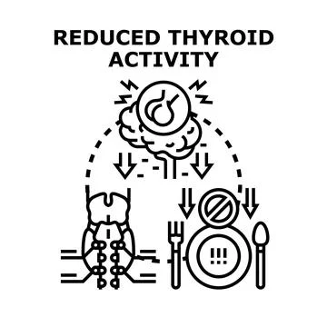 Reduced thyroid activity causing hormonal imbalance and metabolic issues Stock Illustration
