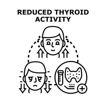 Reduced thyroid activity causing human health problems Stock Illustration