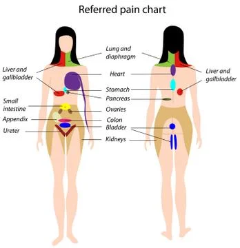 Referred pain chart Stock Illustration