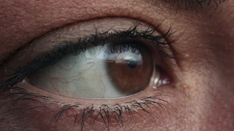  Reflection of clouds in the eye Stock Footage 161468697