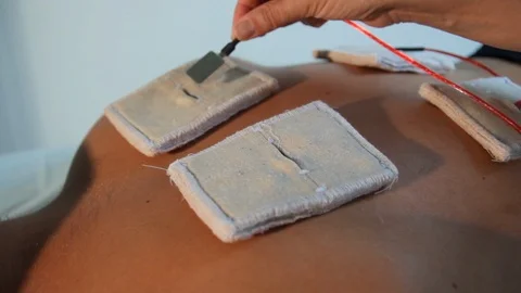 Reflexotherapist fixes electrodes on the patient's back for electrostimulation Stock Footage 116561205