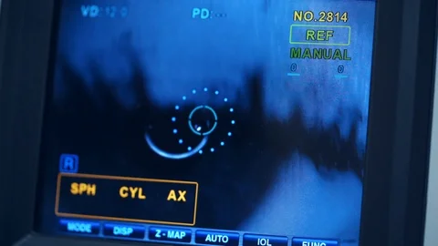Refractometer machine. Patient testing eyes in clinic. Screen showing progress Stock Footage 120248902