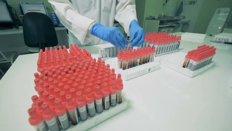 Relocation process of test tubes with blood performed by lab worker Vidéo 92665219