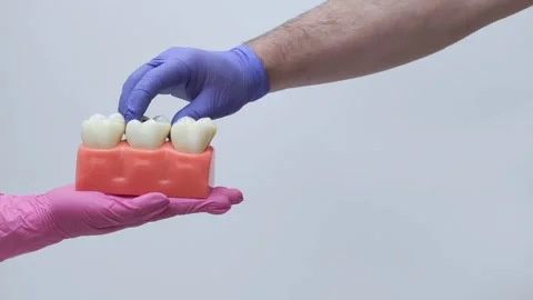 Removable Decayed Tooth Anatomy Model Demonstration Stock Footage 333550579